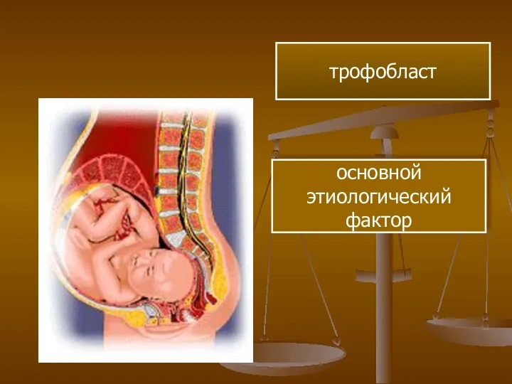 трофобласт основной этиологический фактор