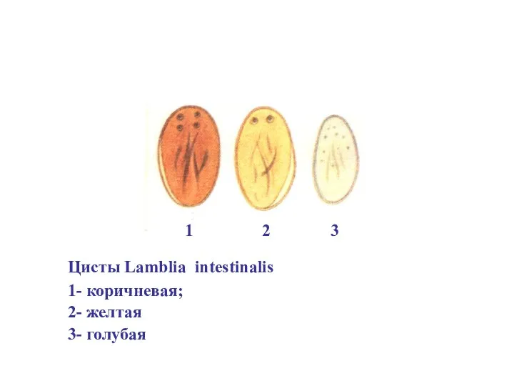 Цисты Lamblia intestinalis 1- коричневая; 2- желтая 3- голубая 1 2 3