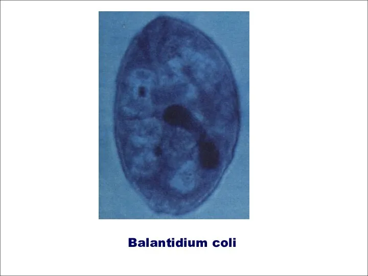 Balantidium coli