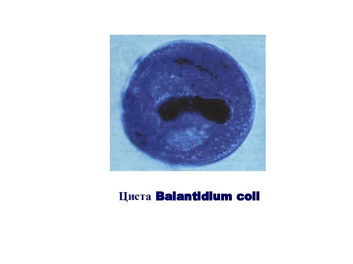Циста Balantidium coli