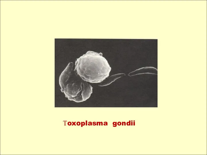 Тoxoplasma gondii