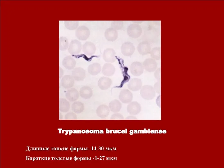 Trypanosoma brucei gambiense Длинные тонкие формы- 14-30 мкм Короткие толстые формы -1-27 мкм