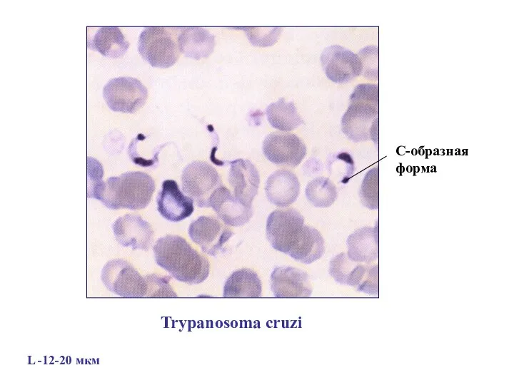 C-образная форма Trypanosoma cruzi L -12-20 мкм