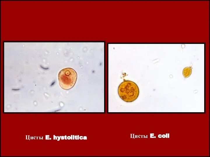 Цисты E. hystolitica Цисты E. coli