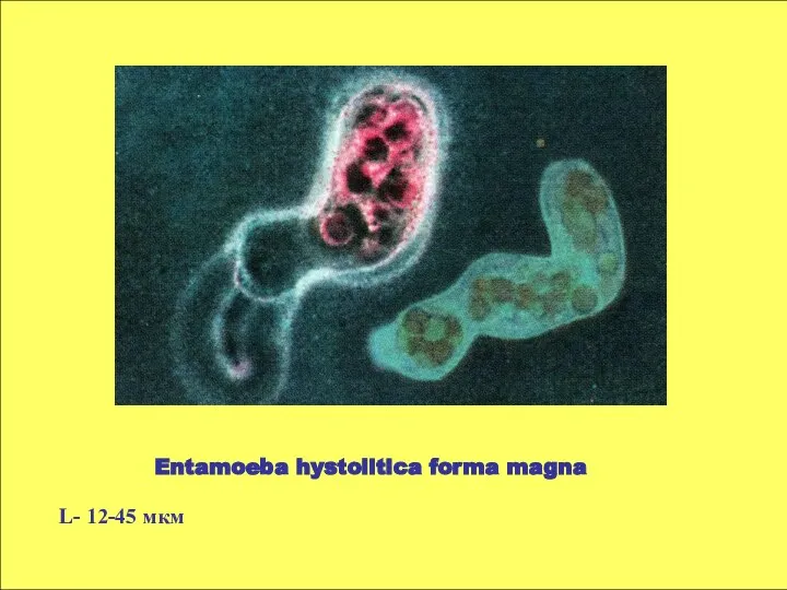 Entamoeba hystolitica forma magna L- 12-45 мкм