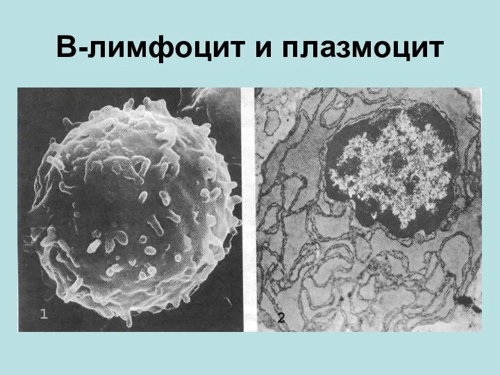 В-лимфоцит и плазмоцит