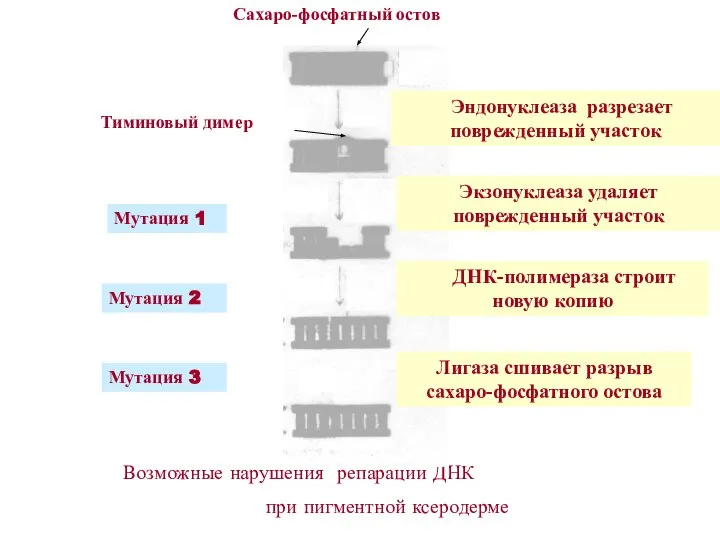 Возможные нарушения репарации ДНК при пигментной ксеродерме Эндонуклеаза разрезает поврежденный участок