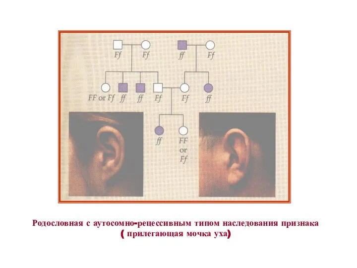 Родословная с аутосомно-рецессивным типом наследования признака ( прилегающая мочка уха)