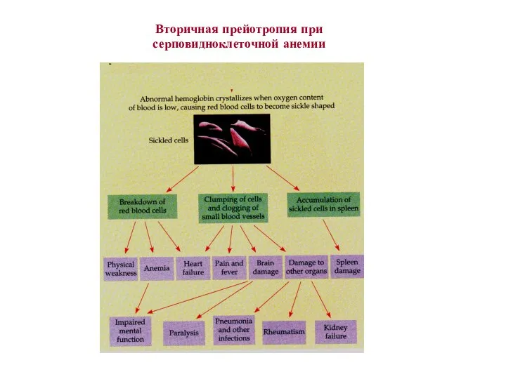 Вторичная прейотропия при серповидноклеточной анемии
