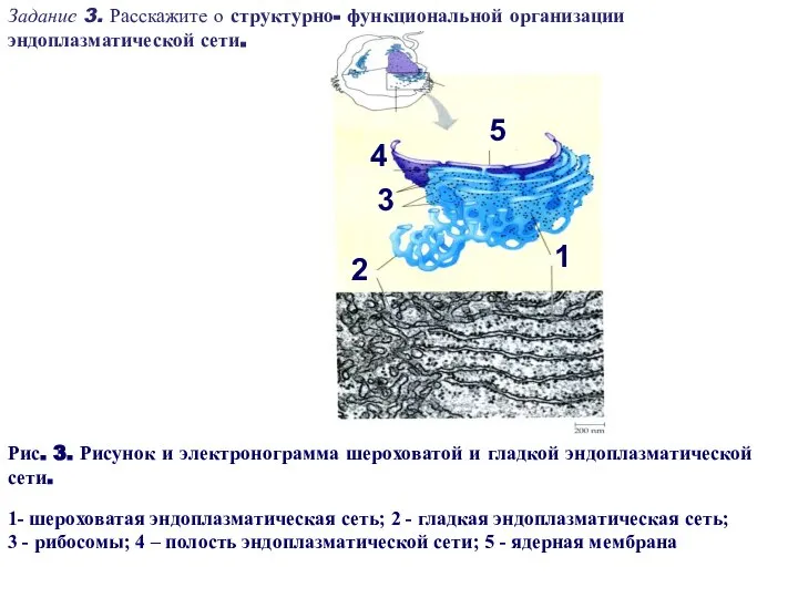 Рис. 3. Рисунок и электронограмма шероховатой и гладкой эндоплазматической сети. 1-