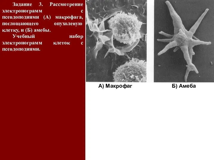 Задание 3. Рассмотрение электронограмм с псевдоподиями (А) макрофага, поглощающего опухолевую клетку,