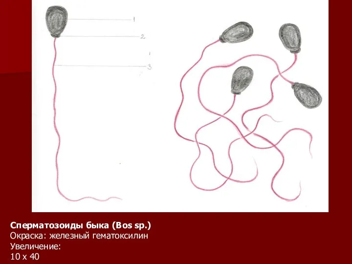 Сперматозоиды быка (Bos sp.) Окраска: железный гематоксилин Увеличение: 10 х 40
