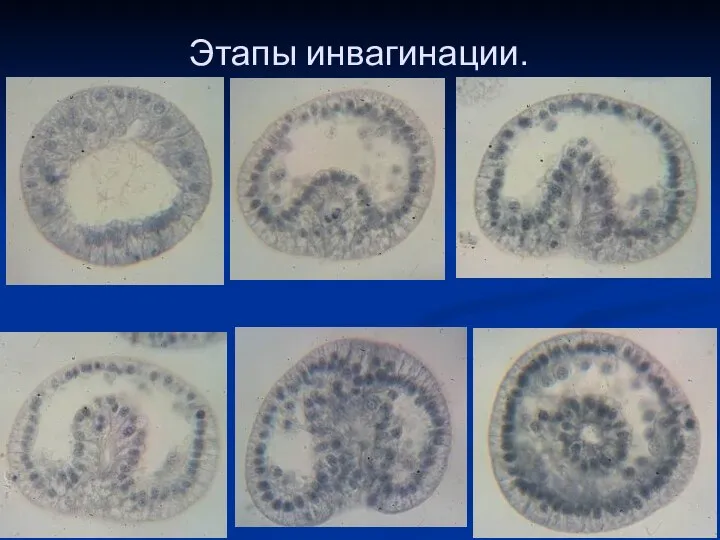 Этапы инвагинации.