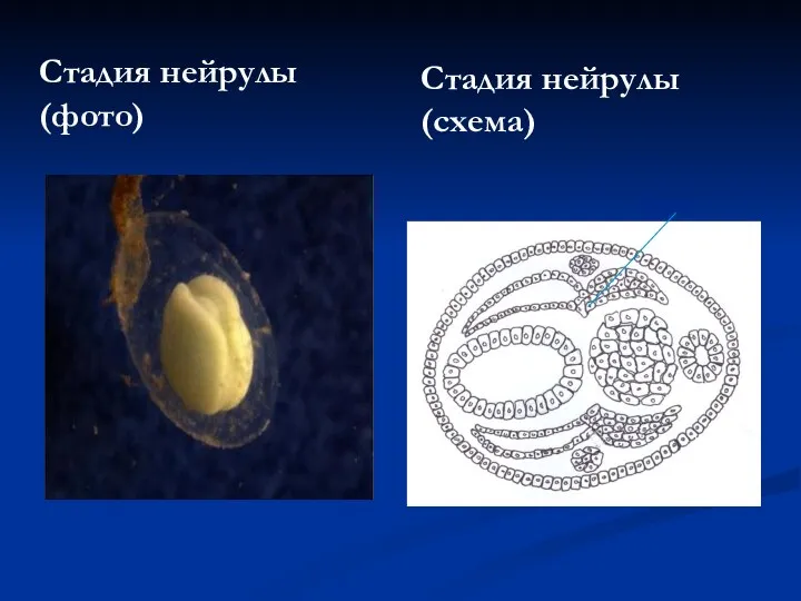 Стадия нейрулы (фото) Стадия нейрулы (схема) Хорда