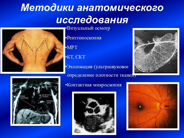 Визуальный осмотр Рентгеноскопия МРТ КТ, СКТ Эхолокация (ультразвуковое определение плотности тканей) Контактная микроскопия Методики анатомического исследования