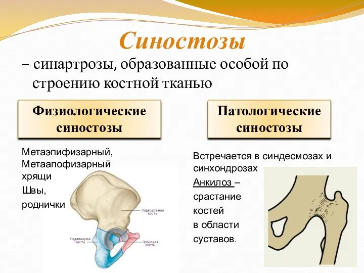 Синостозы – синартрозы, образованные особой по строению костной тканью Физиологические синостозы