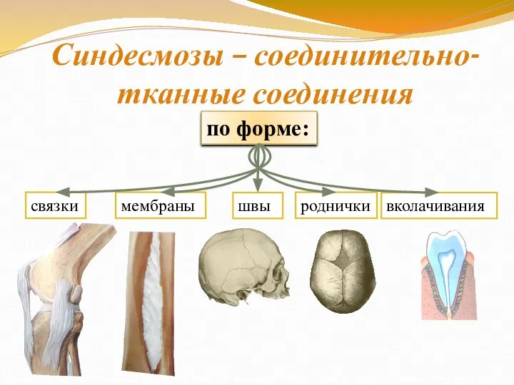 Синдесмозы – соединительно- тканные соединения по форме: мембраны связки швы роднички вколачивания