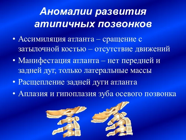 Аномалии развития атипичных позвонков Ассимиляция атланта – сращение с затылочной костью