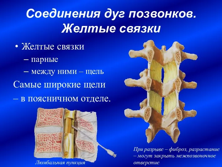 Соединения дуг позвонков. Желтые связки Желтые связки парные между ними –