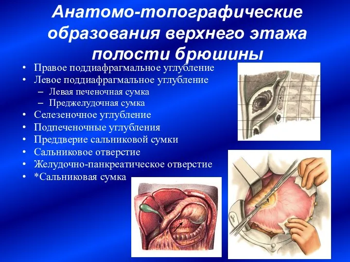 Анатомо-топографические образования верхнего этажа полости брюшины Правое поддиафрагмальное углубление Левое поддиафрагмальное