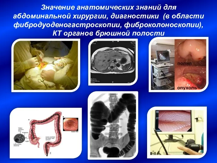 Значение анатомических знаний для абдоминальной хирургии, диагностики (в области фибродуоденогастроскопии, фиброколоноскопии), КТ органов брюшной полости
