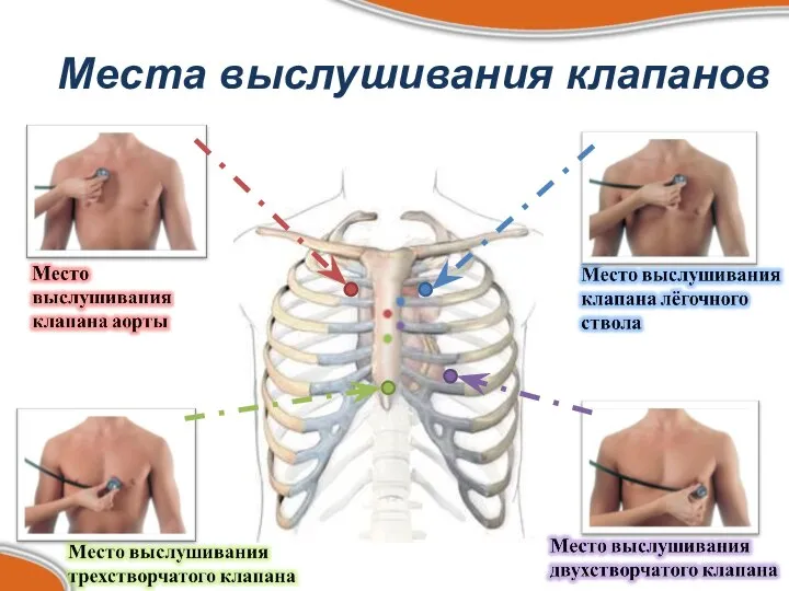 Места выслушивания клапанов