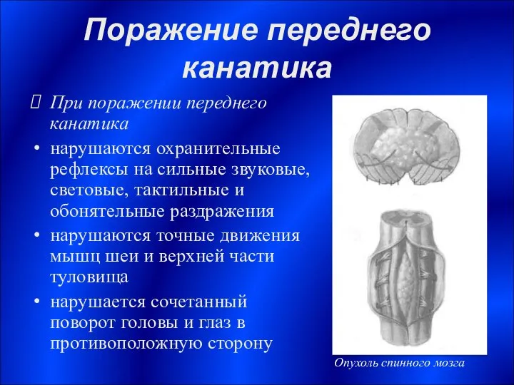 Поражение переднего канатика При поражении переднего канатика нарушаются охранительные рефлексы на