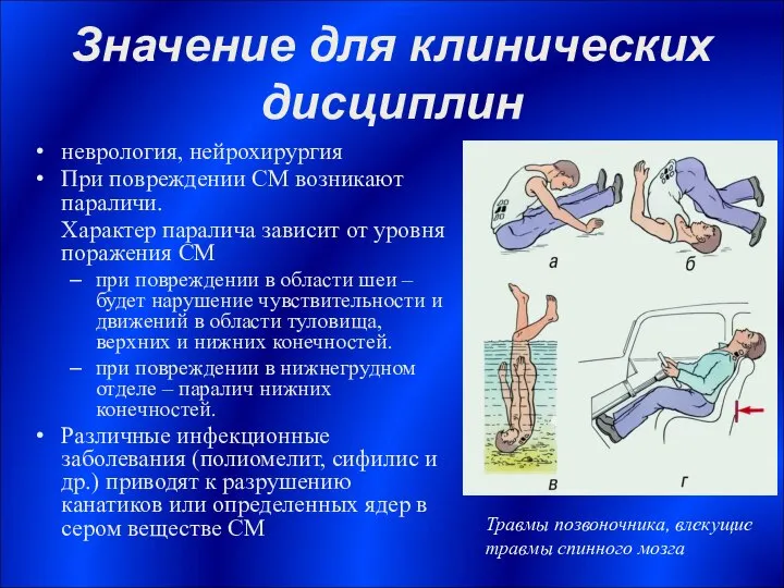 Значение для клинических дисциплин неврология, нейрохирургия При повреждении СМ возникают параличи.