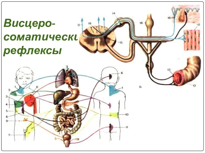 Висцеро-соматические рефлексы