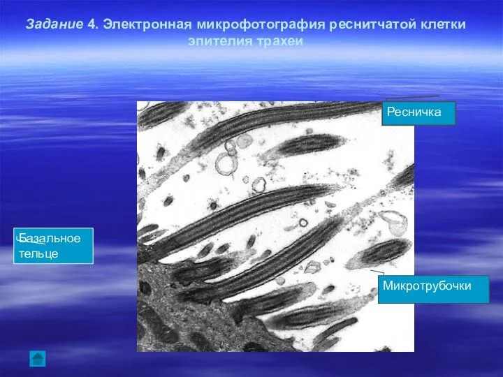 Задание 4. Электронная микрофотография реснитчатой клетки эпителия трахеи Ресничка Микротрубочки Базальное тельце