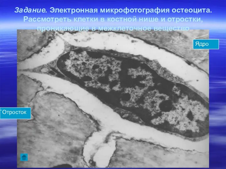 Задание. Электронная микрофотография остеоцита. Рассмотреть клетки в костной нише и отростки,