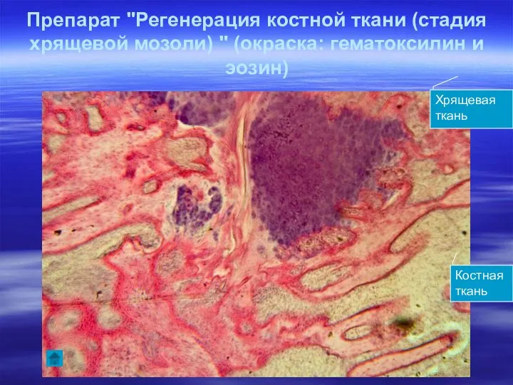 Препарат "Регенерация костной ткани (стадия хрящевой мозоли) " (окраска: гематоксилин и эозин) Хрящевая ткань Костная ткань