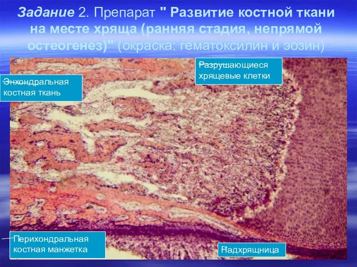 Задание 2. Препарат " Развитие костной ткани на месте хряща (ранняя