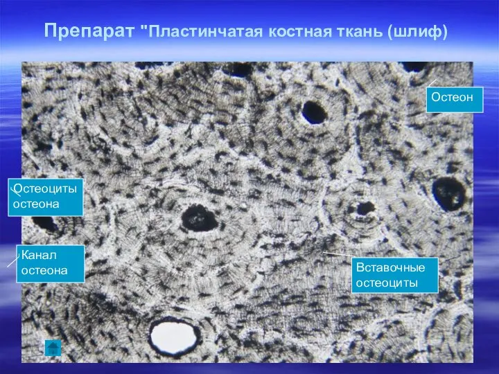 Препарат "Пластинчатая костная ткань (шлиф) Остеон Канал остеона Вставочные остеоциты Остеоциты остеона