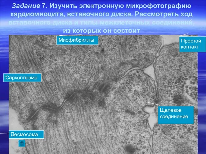 Задание 7. Изучить электронную микрофотографию кардиомиоцита, вставочного диска. Рассмотреть ход вставочного