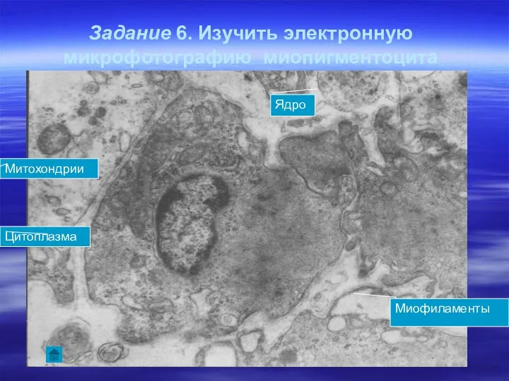 Задание 6. Изучить электронную микрофотографию миопигментоцита Ядро Цитоплазма Миофиламенты Митохондрии