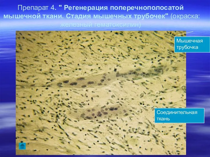 Препарат 4. " Регенерация поперечнополосатой мышечной ткани. Стадия мышечных трубочек" (окраска: