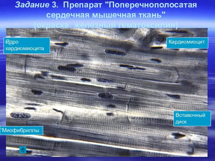 Задание 3. Препарат "Поперечнополосатая сердечная мышечная ткань" (окраска: железный гематоксилин) Кардиомиоцит Вставочный диск Миофибриллы Ядро кардиомиоцита