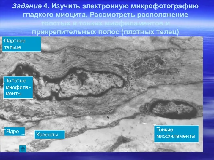 Задание 4. Изучить электронную микрофотографию гладкого миоцита. Рассмотреть расположение толстых и