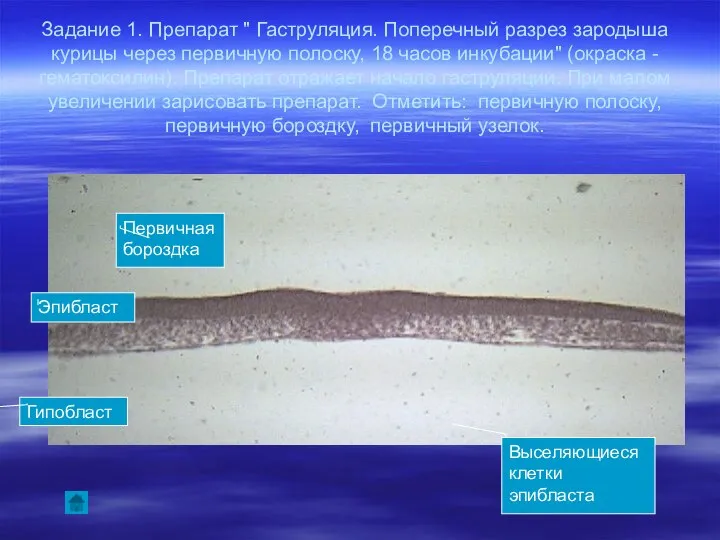 Задание 1. Препарат " Гаструляция. Поперечный разрез зародыша курицы через первичную