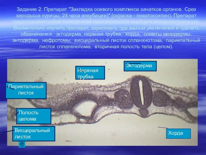 Задание 2. Препарат "Закладка осевого комплекса зачатков органов. Срез зародыша курицы,