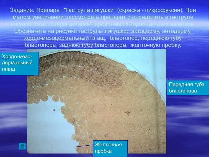 Задание. Препарат "Гаструла лягушки" (окраска - пикрофуксин). При малом увеличении рассмотреть