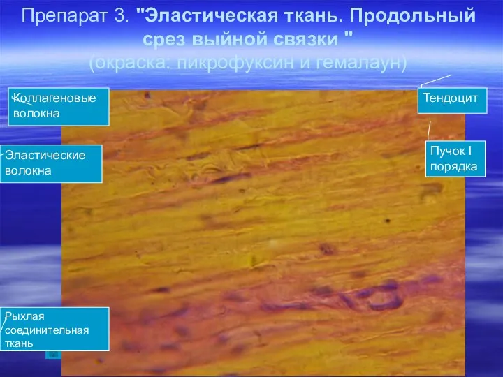 Препарат 3. "Эластическая ткань. Продольный срез выйной связки " (окраска: пикрофуксин