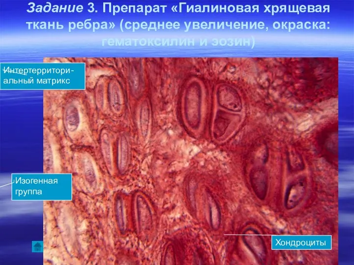 Задание 3. Препарат «Гиалиновая хрящевая ткань ребра» (среднее увеличение, окраска: гематоксилин