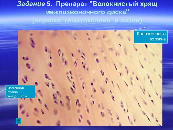 Задание 5. Препарат "Волокнистый хрящ межпозвоночного диска" (окраска: гематоксилин и эозин) Коллагеновые волокна Изогенная группа хондроцитов