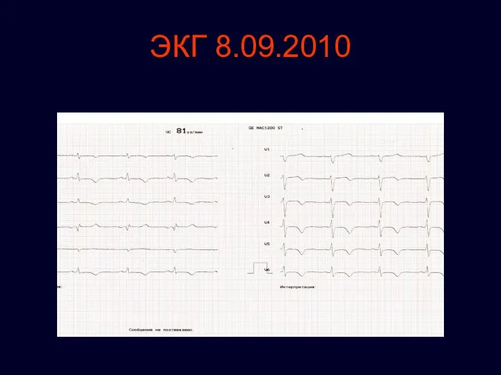 ЭКГ 8.09.2010