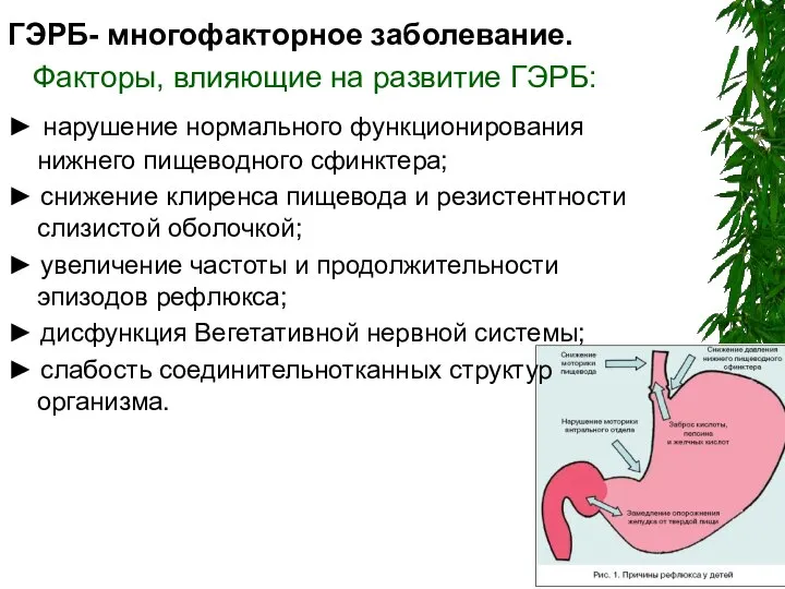 ГЭРБ- многофакторное заболевание. Факторы, влияющие на развитие ГЭРБ: ► нарушение нормального