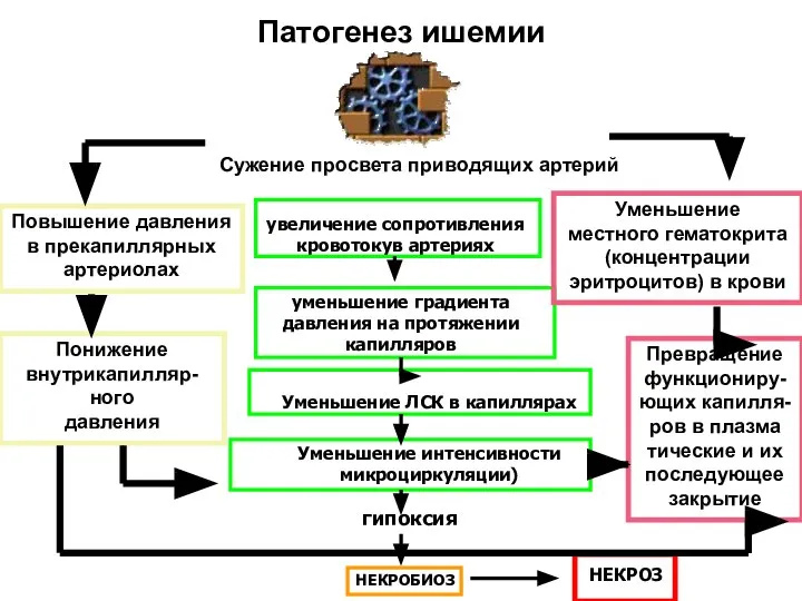 Патогенез ишемии увеличение сопротивления кровотокув артериях уменьшение градиента давления на протяжении