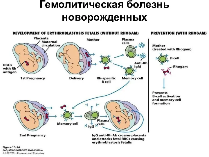 Гемолитическая болезнь новорожденных