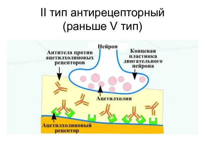 II тип антирецепторный (раньше V тип)